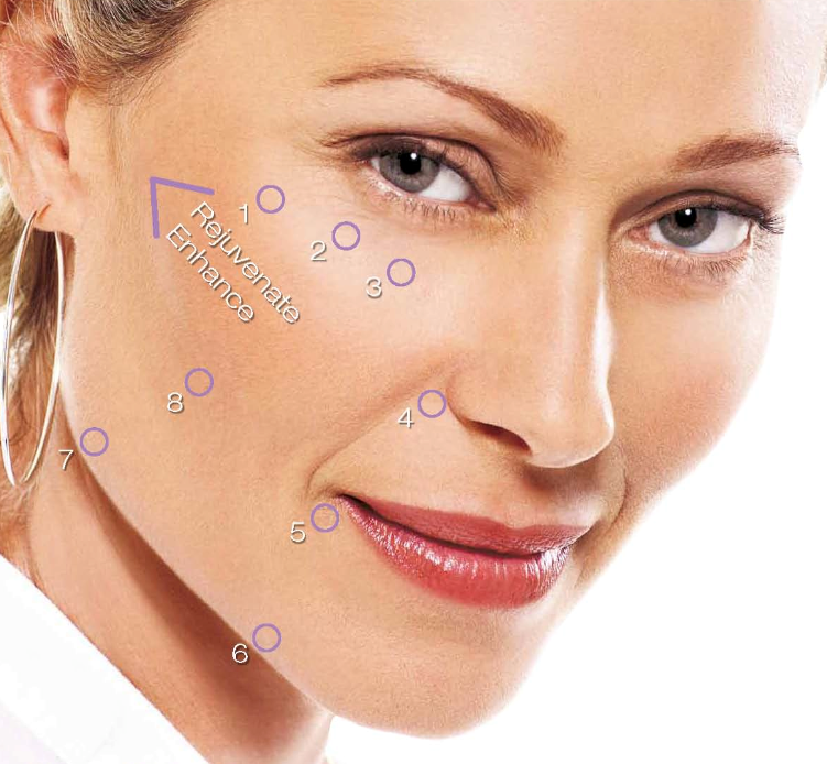 Juvederm 8 point lift Utopian Cosmetics Cosmetic Surgery Perth